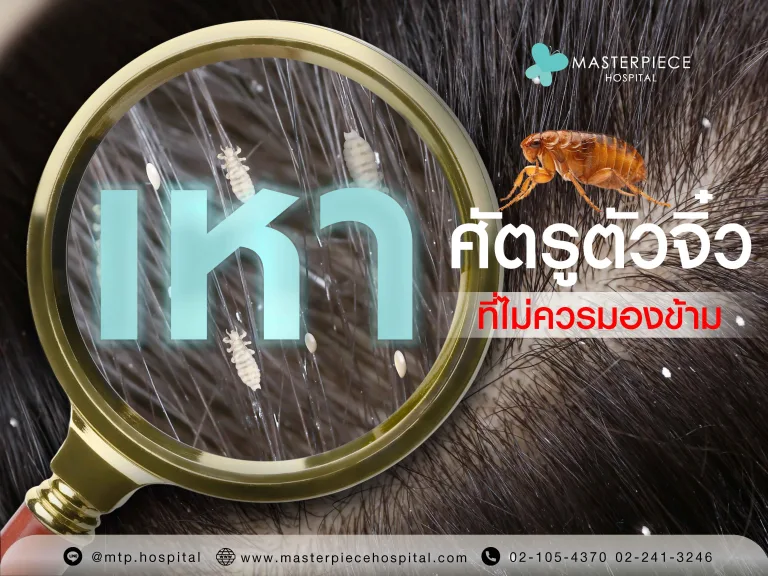 เหา ศัตรูตัวจิ๋วที่ไม่ควรมองข้าม