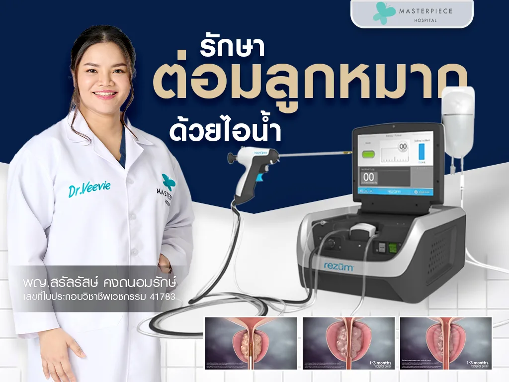 รักษาต่อมลูกหมากด้วยไอน้ำ