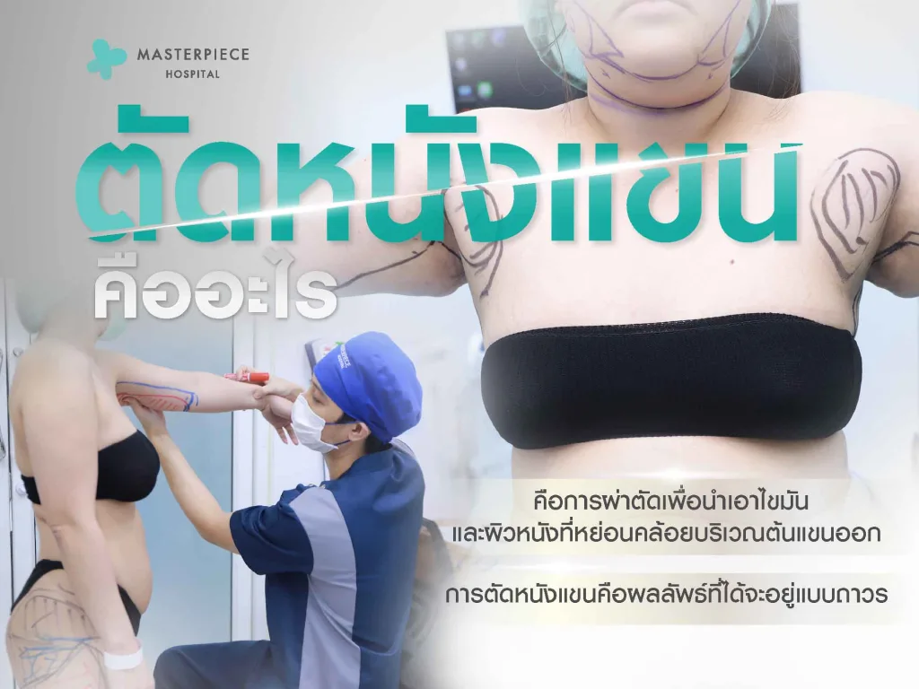 ตัดหนังแขนคืออะไร