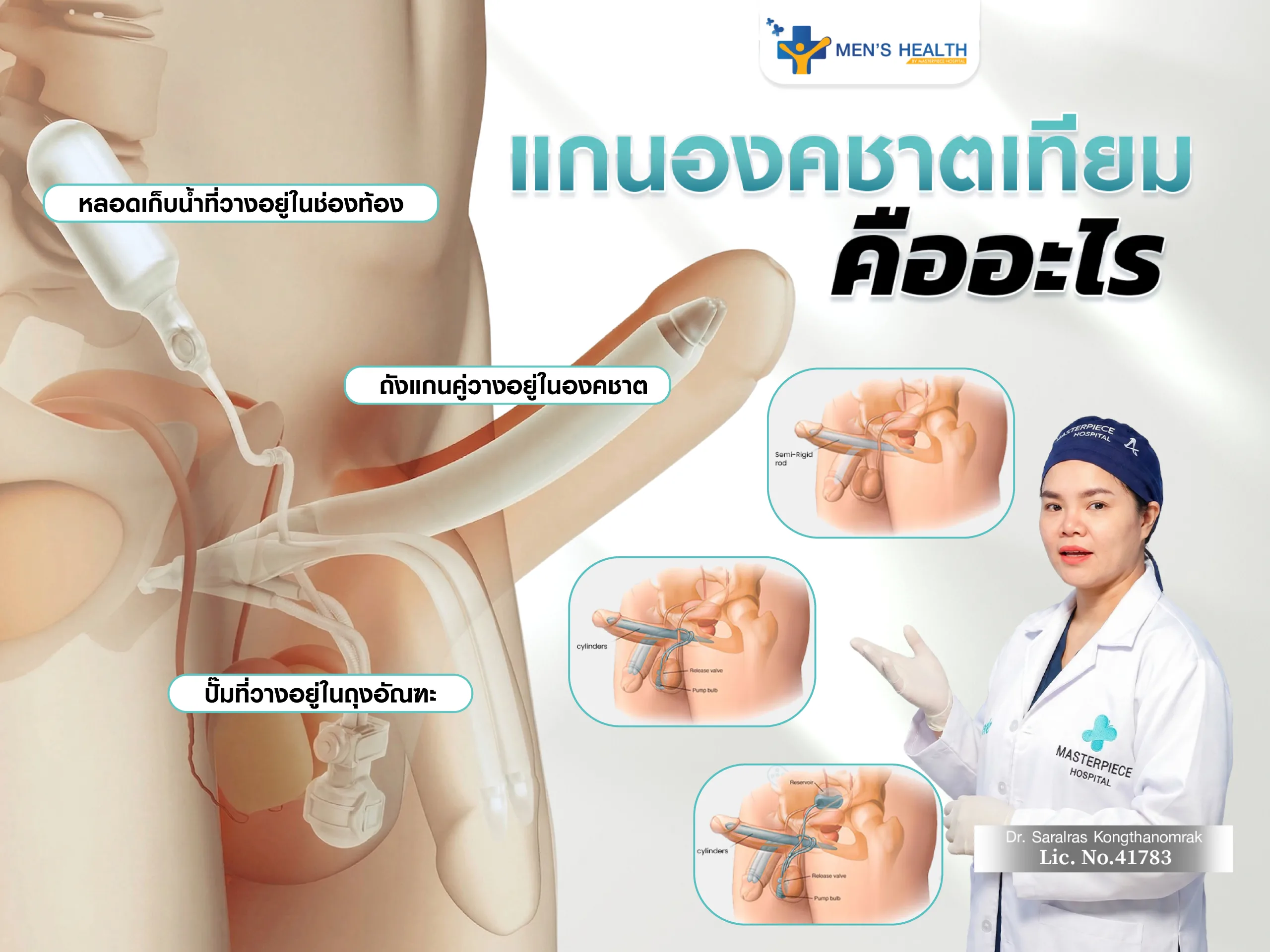 แกนองคชาตเทียม คืออะไร