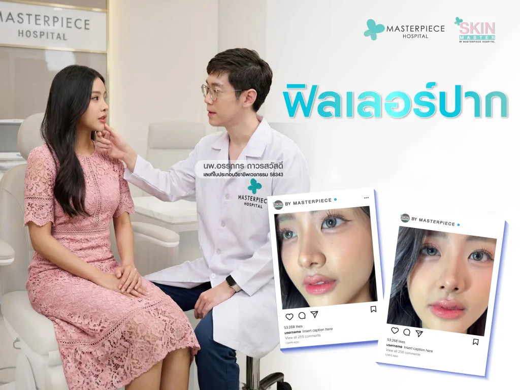 ฟิลเลอร์ปากสายฝอคือ