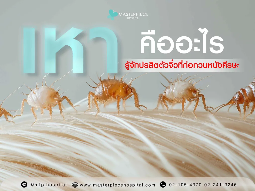 เหาคืออะไร? รู้จักปรสิตตัวจิ๋วที่ก่อกวนหนังศีรษะ