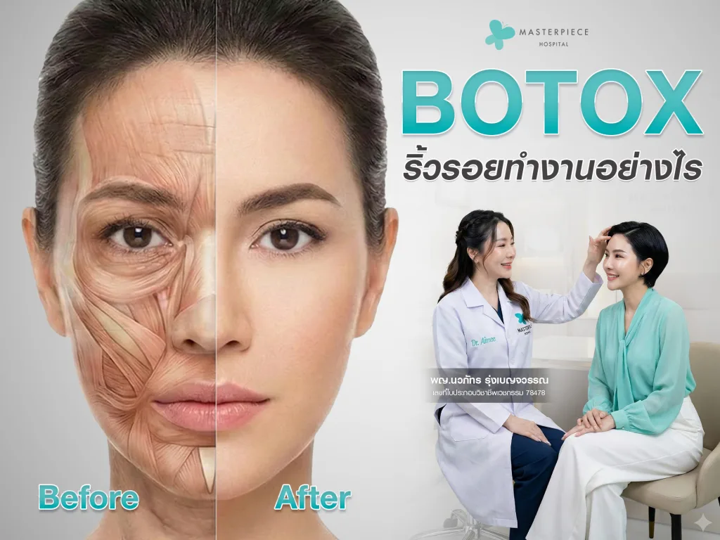 Botox ริ้วรอยทำงานอย่างไร