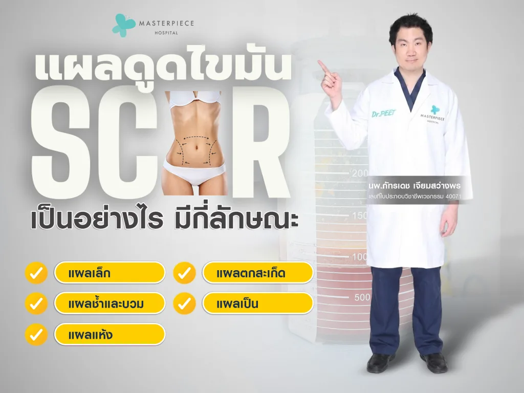 แผลดูดไขมันเป็นอย่างไรมีกี่ลักษณะ