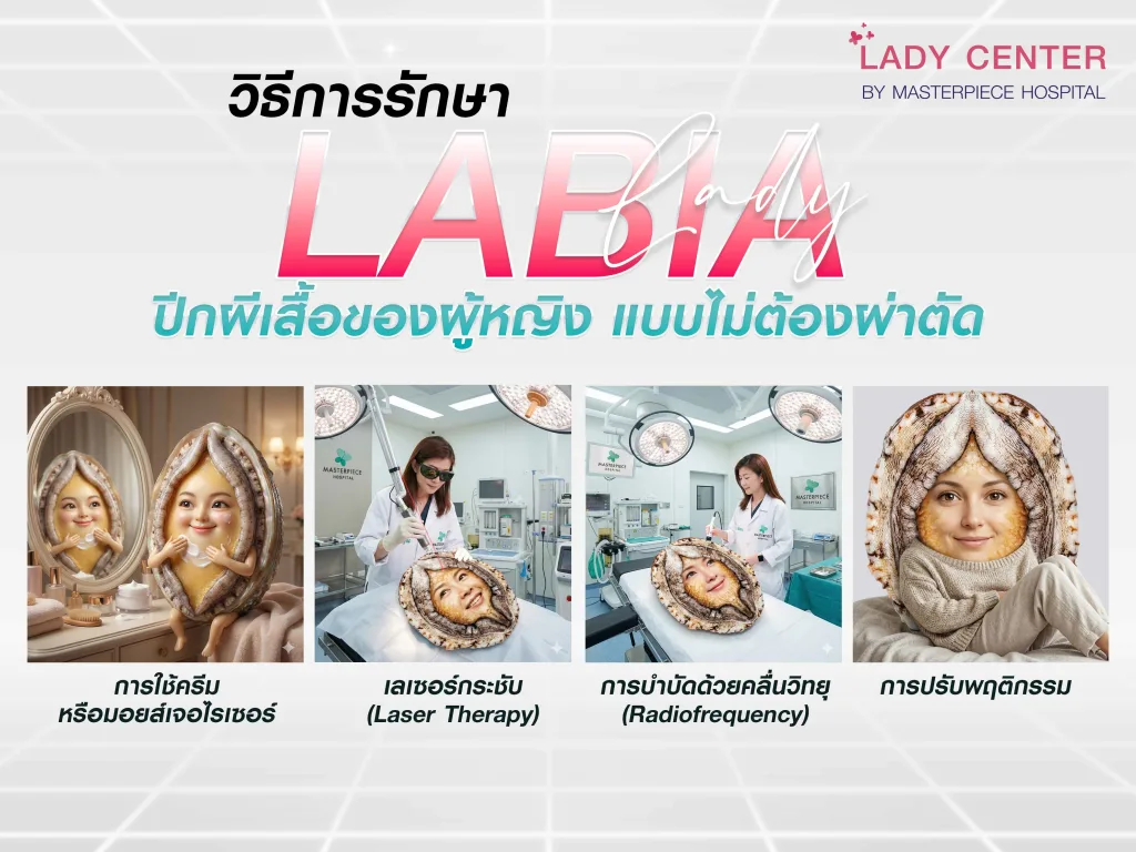 วิธีการรักษา ปีกผีเสื้อของผู้หญิง แบบไม่ต้องผ่าตัด