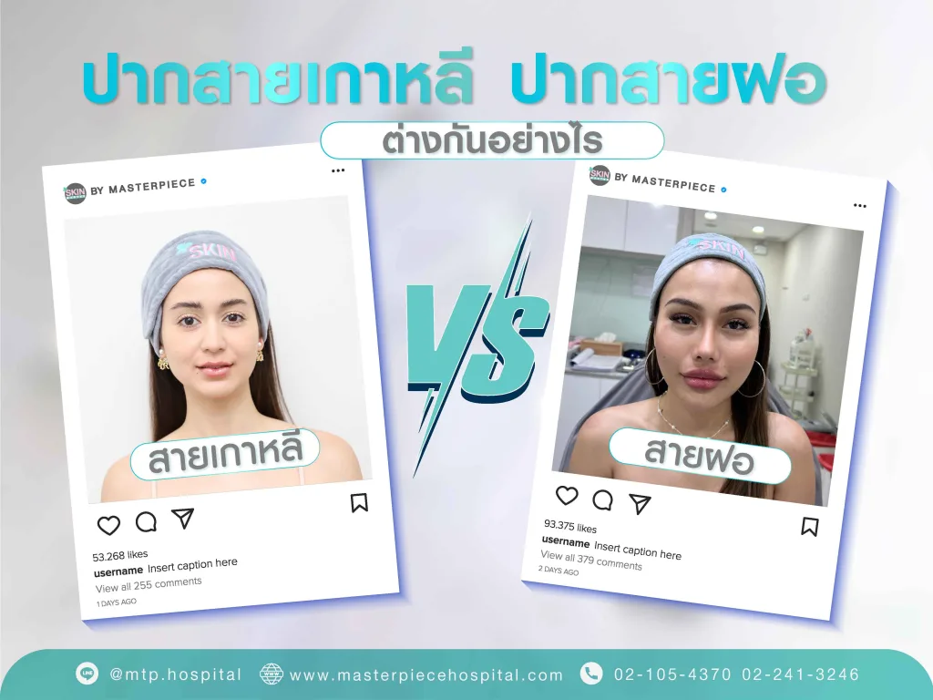 ปากสายฝอ กับ ปากสายเกาหลีต่างกันอย่างไร