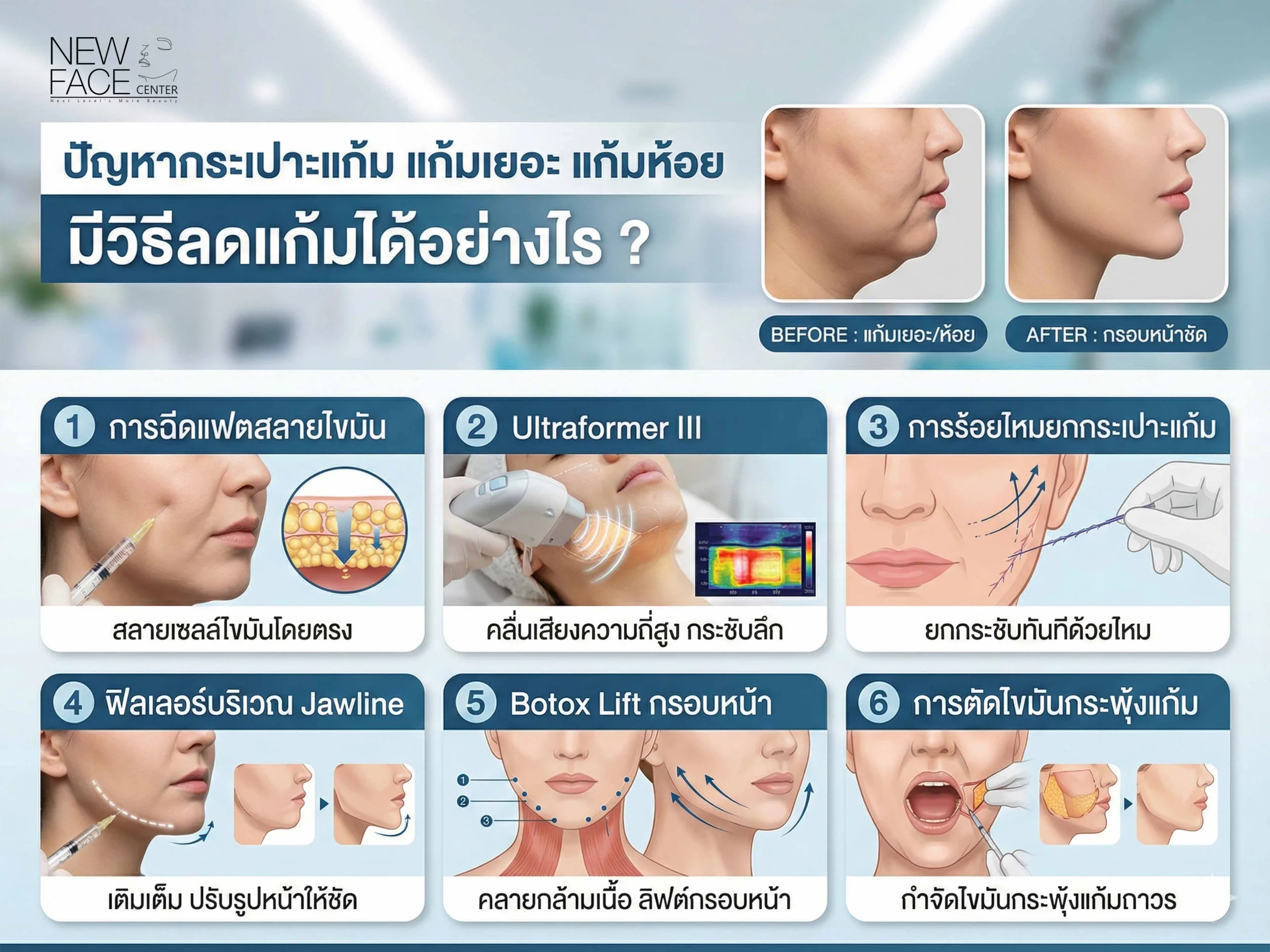 ปัญหากระเปาะแก้ม