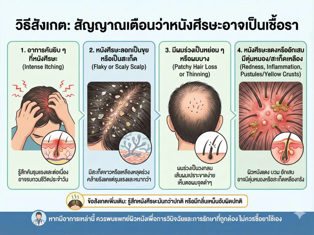 วิธีสังเกตว่าหัวอาจเป็นเชื้อรา