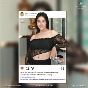 review bodycontouring influencer