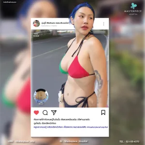 review bodycontouring influencer