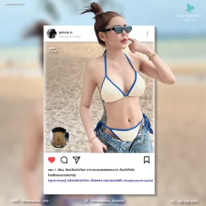 review bodycontouring influencer