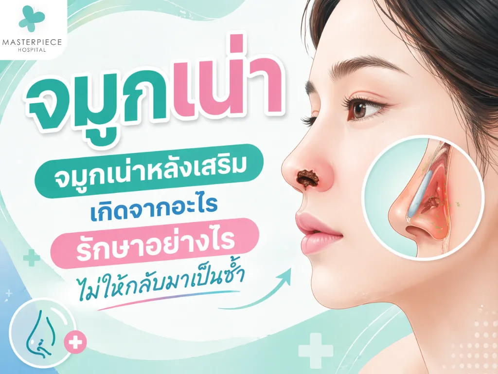 จมูกเน่า จมูกเน่าหลังเสริมเกิดจากอะไร รักษาอย่างไรไม่ให้กลับมาเป็นซ้ำ