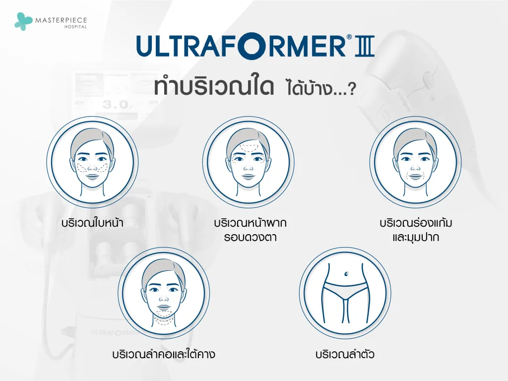 Ultraformer III ทำบริเวณใดได้บ้าง