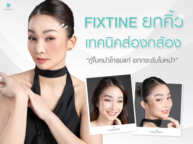 Fixtineยกคิ้วเทคนิคส่องกล้อง