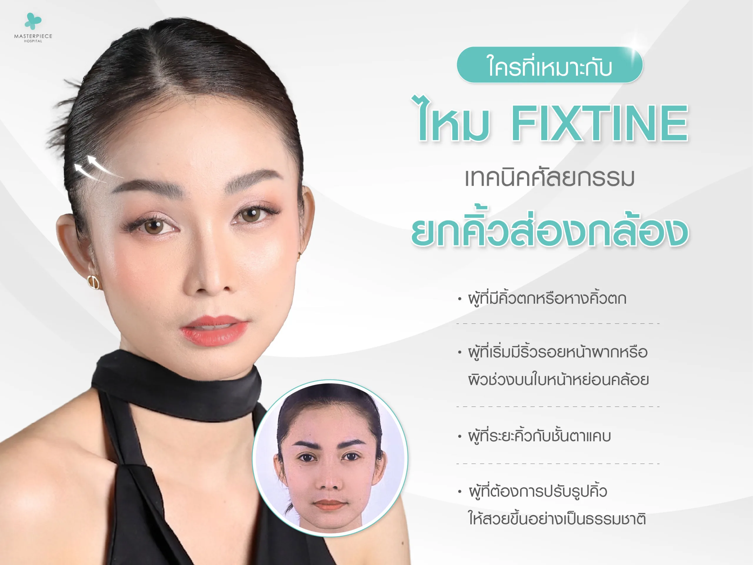 ใครที่เหมาะกับไหม Fixtine