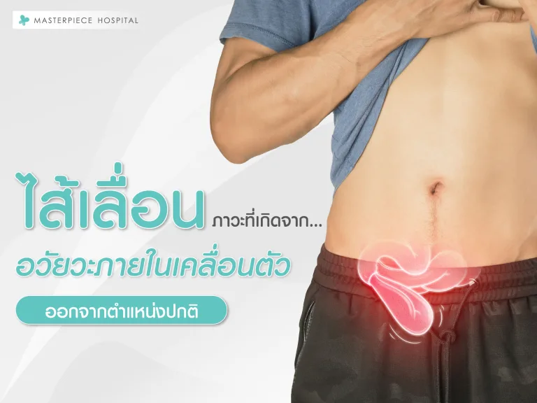 ไส้เลื่อน คืออะไร