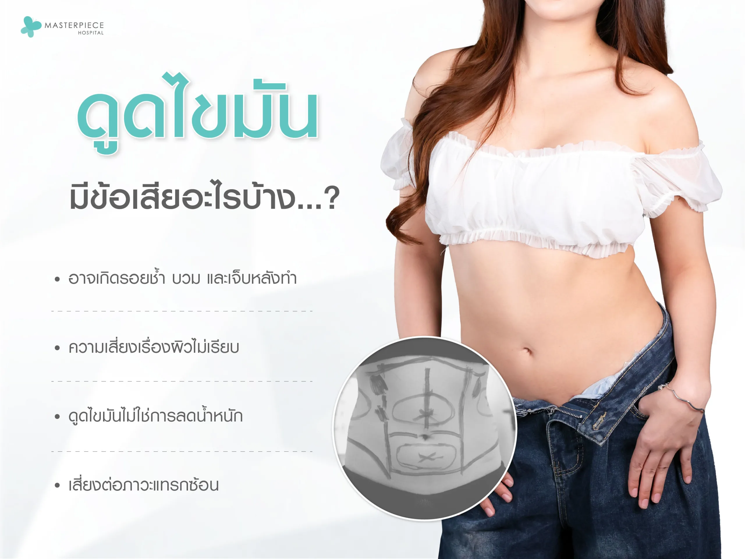 ดูดไขมันมีข้อเสียอะไรบ้าง