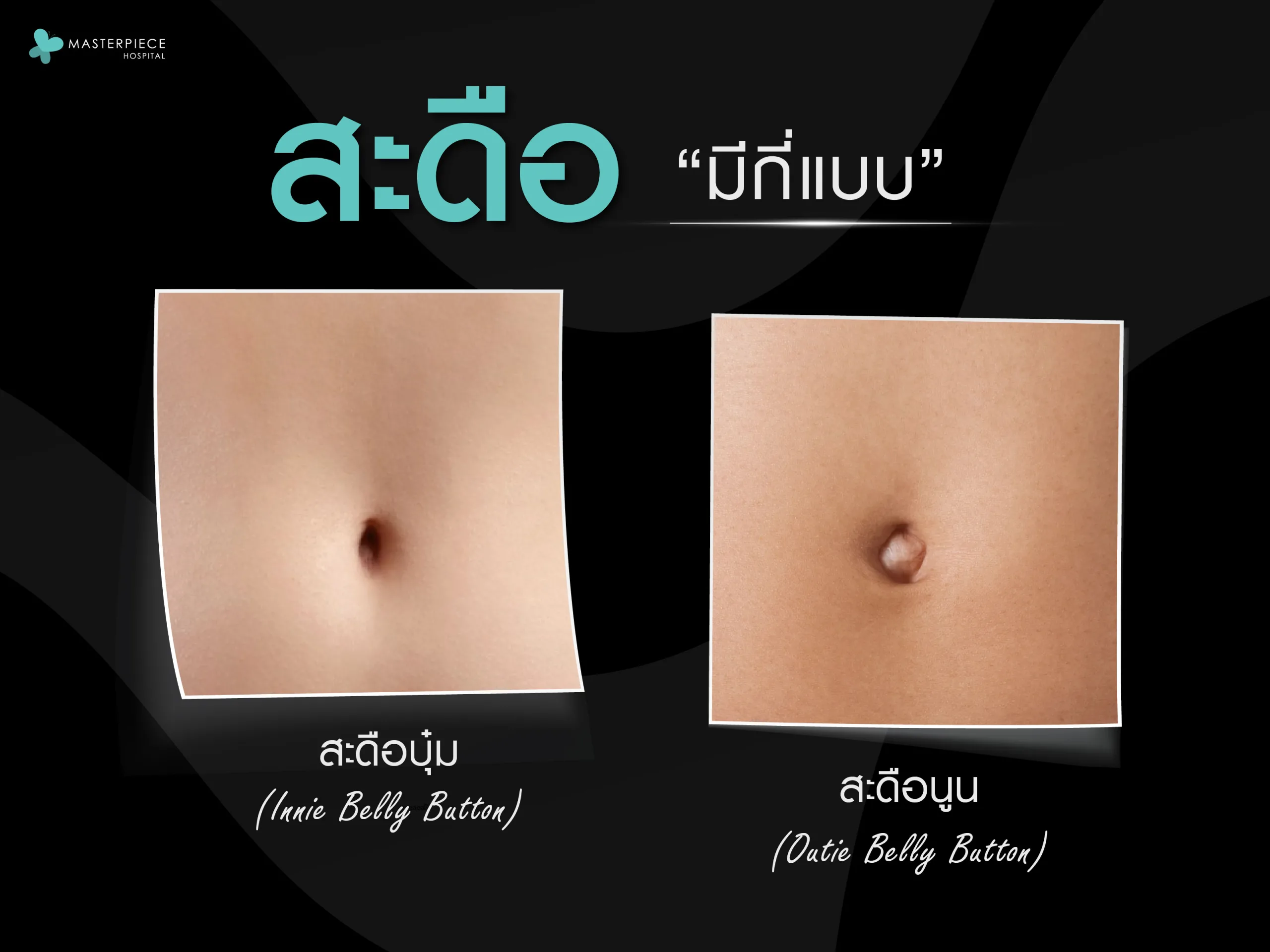 สะดือมีกี่แบบ