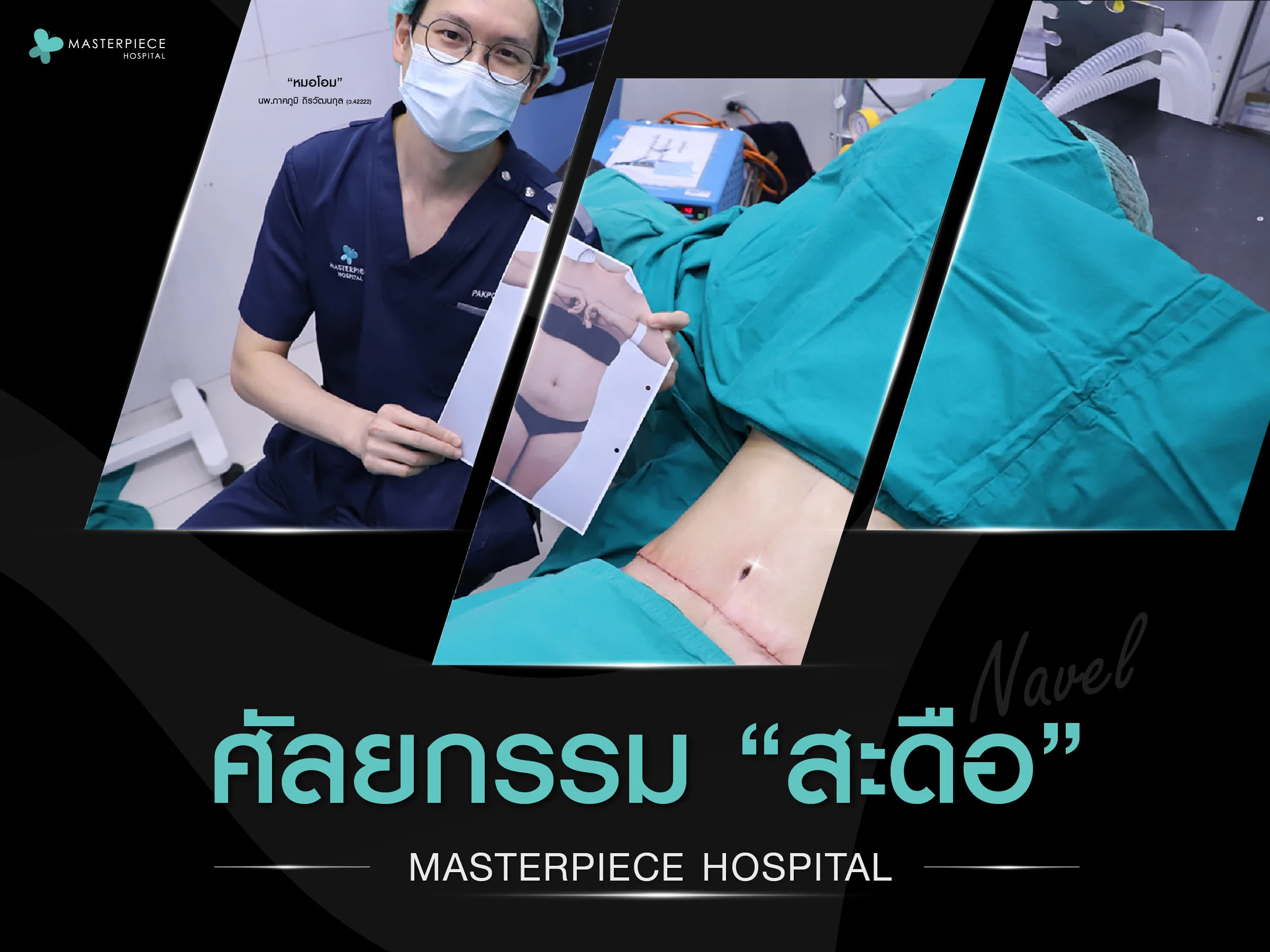 ถ้าไม่ชอบสะดือที่เรามี ศัลยกรรมสะดือ