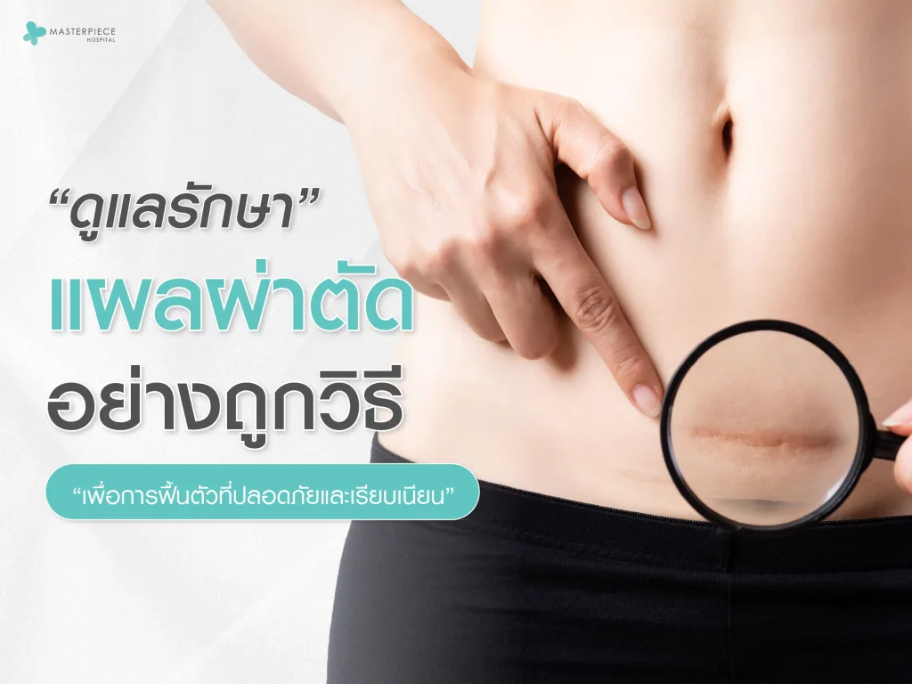 ดูแลและรักษาแผลผ่าตัดอย่างถูกวิธี เพื่อการฟื้นตัวที่ปลอดภัยและเรียบเนียน