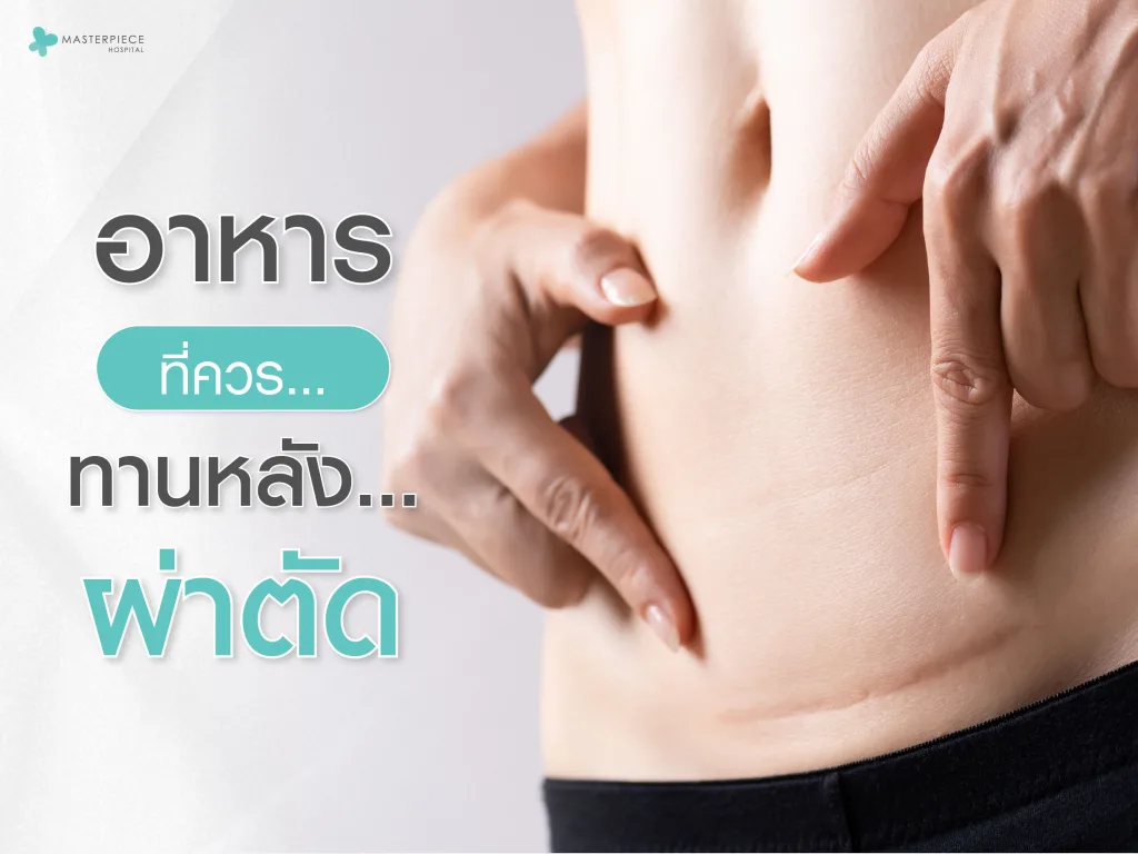 อาหารที่ควรทานหลังผ่าตัด