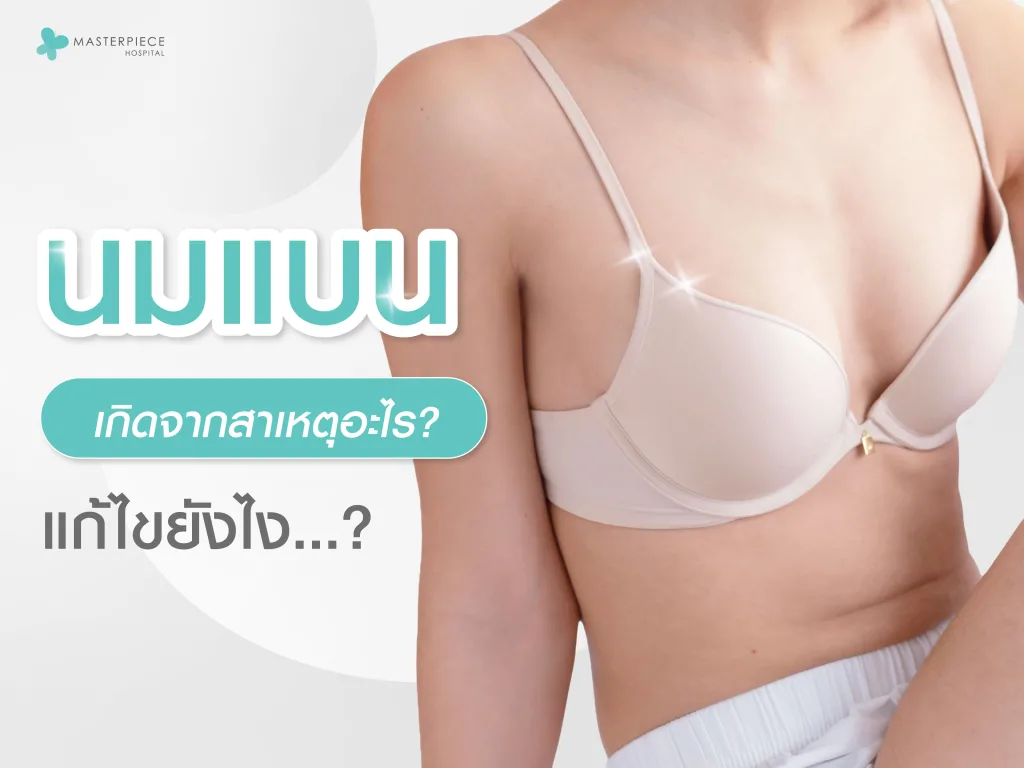 นมแบน เกิดจากสาเหตุอะไร แก้ไขได้อย่างไร ?