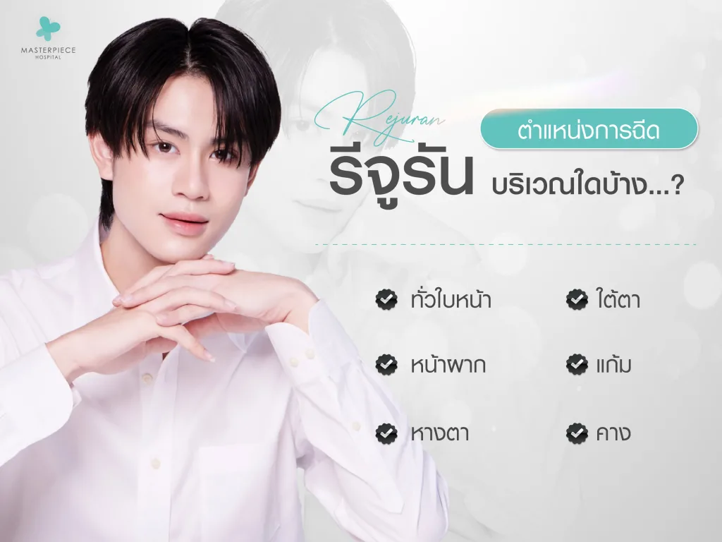 ตำแหน่งการฉีดรีจูรัน บริเวณใดบ้าง