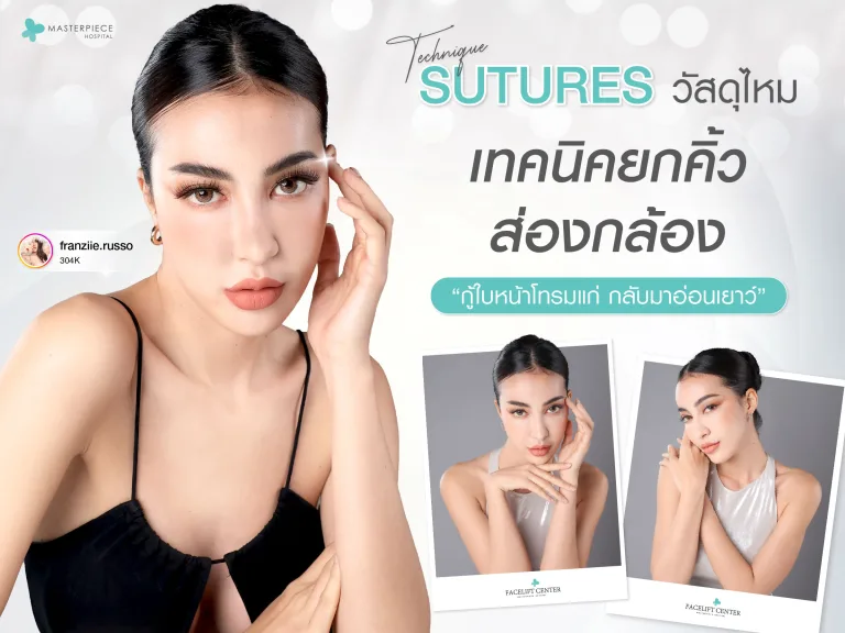Sutures วัสดุไหมเทคนิคยกคิ้ว ส่องกล้อง กู้ใบหน้าโทรมแก่ กลับมาอ่อนเยาว์?