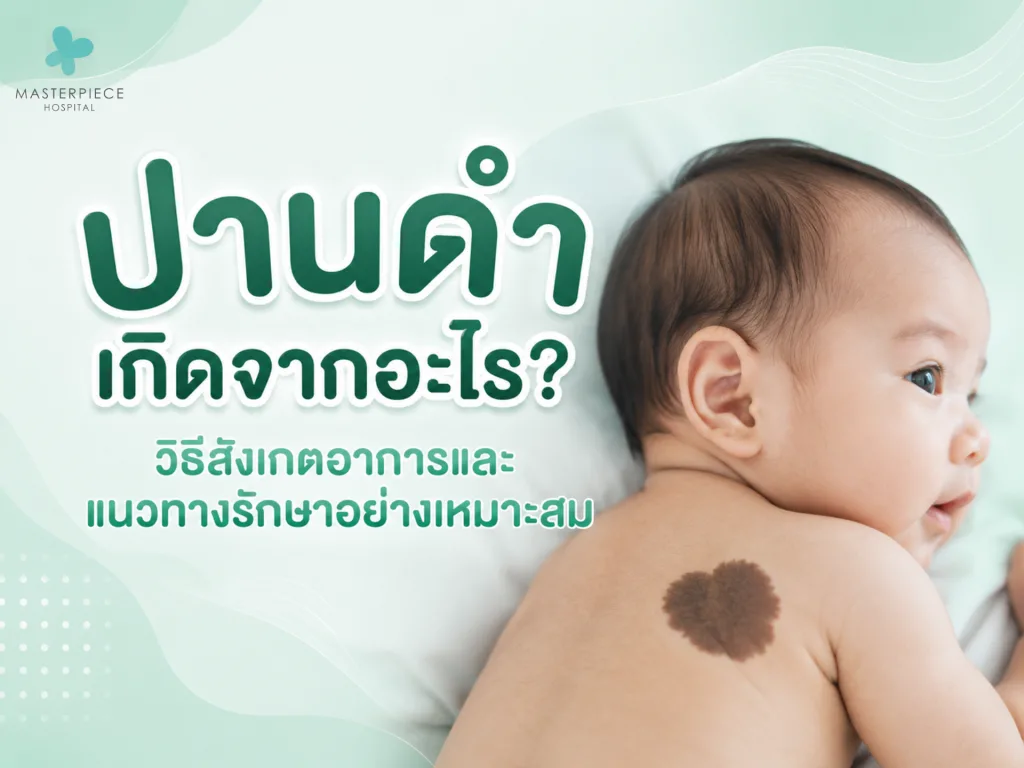 ปานดำเกิดจากอะไร? วิธีสังเกตอาการและแนวทางรักษาอย่างเหมาะสม