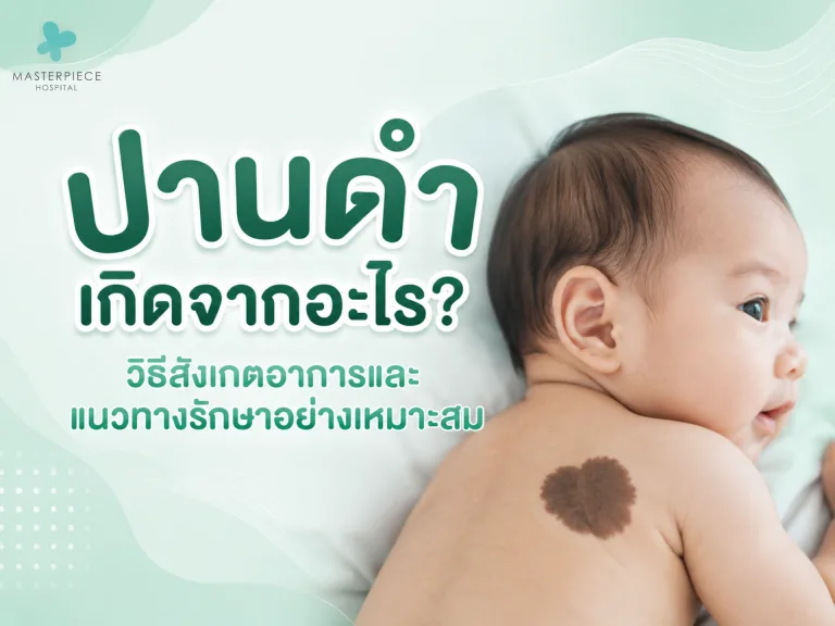 ปานดำเกิดจากอะไร? วิธีสังเกตอาการและแนวทางรักษาอย่างเหมาะสม