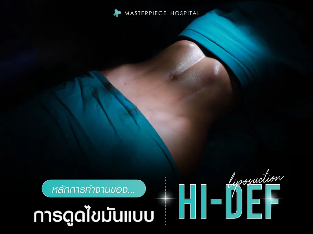 หลักการทำงานของการดูดไขมันแบบ Hi-Def