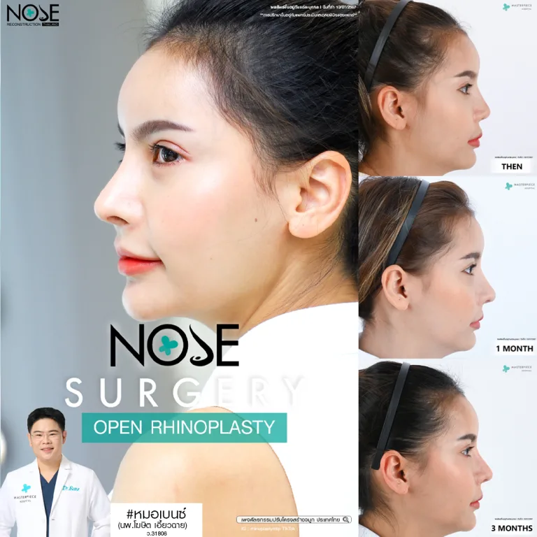 รีวิวจมูกหมอเบ็นซ์
