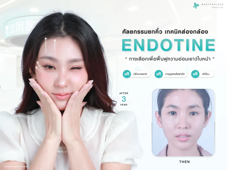 การยกคิ้วด้วย Endotine ทางเลือกเพื่อฟื้นฟูความอ่อนเยาว์ของใบหน้า