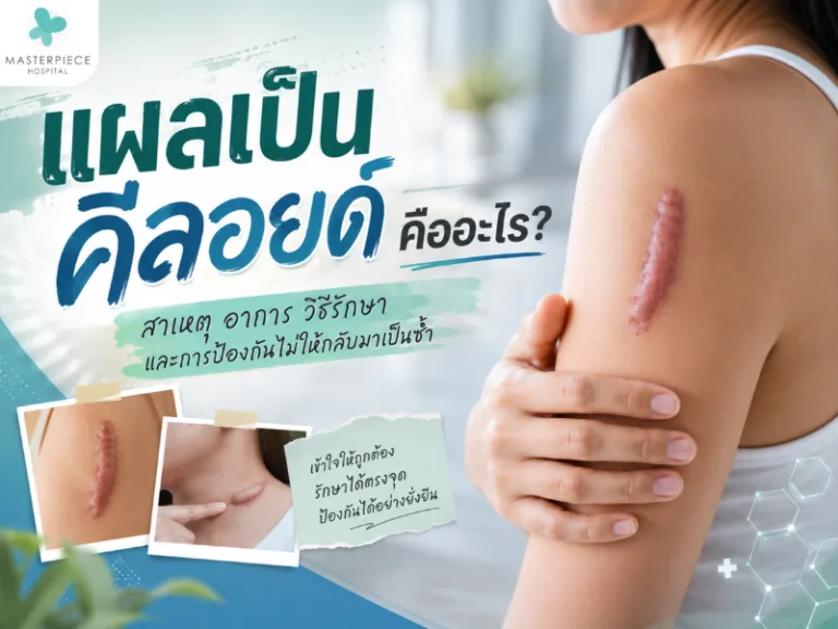 แผลเป็นคีลอยด์คืออะไร? สาเหตุ อาการ วิธีรักษา และการป้องกันไม่ให้กลับมาเป็นซ้ำ