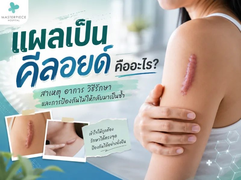 แผลเป็นคีลอยด์คืออะไร? สาเหตุ อาการ วิธีรักษา และการป้องกันไม่ให้กลับมาเป็นซ้ำ