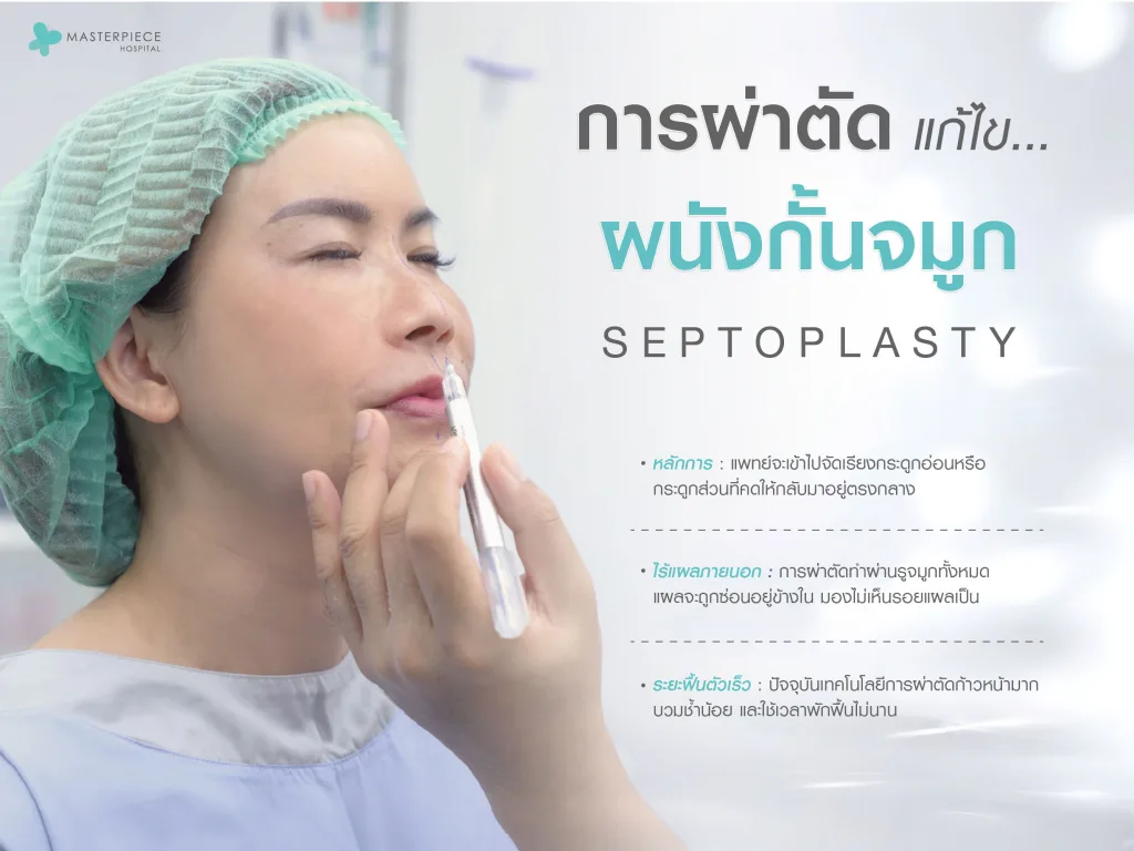 การผ่าตัดแก้ไขผนังกั้นจมูก (Septoplasty)