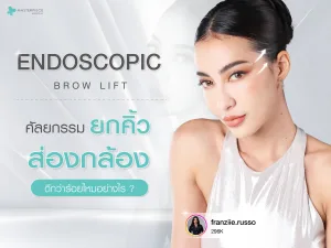 Endoscopic Brow Lift ศัลยกรรมยกคิ้วส่องกล้อง ดีกว่าร้อยไหมอย่างไร?