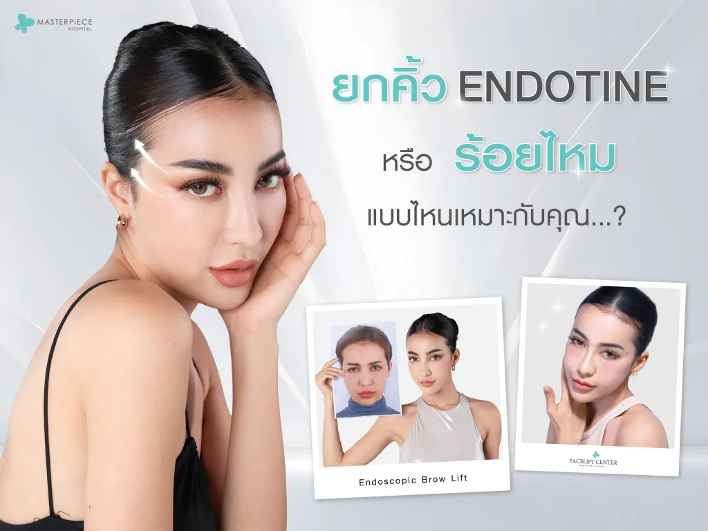 ยกคิ้ว Endotine หรือร้อยไหม แบบไหนเหมาะกับคุณ?