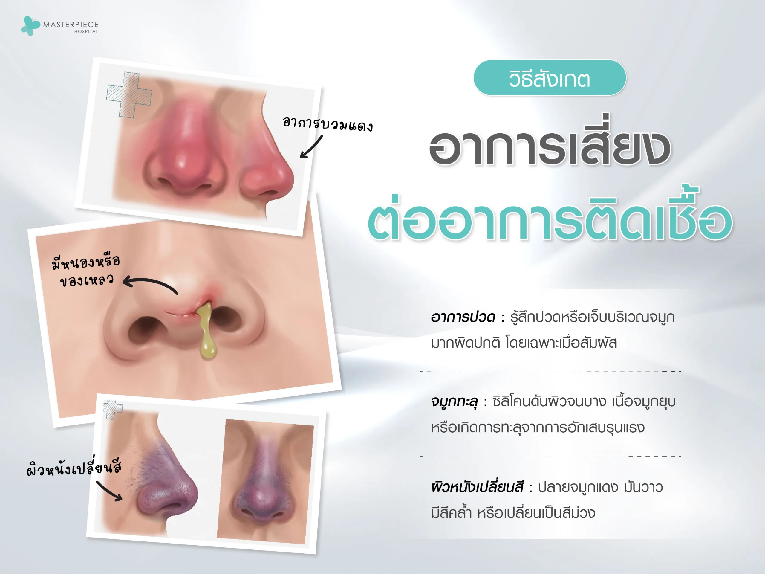 วิธีสังเกตอาการเสี่ยงต่ออาการติดเชื้อ