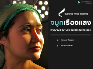 จมูกเรืองแสง
