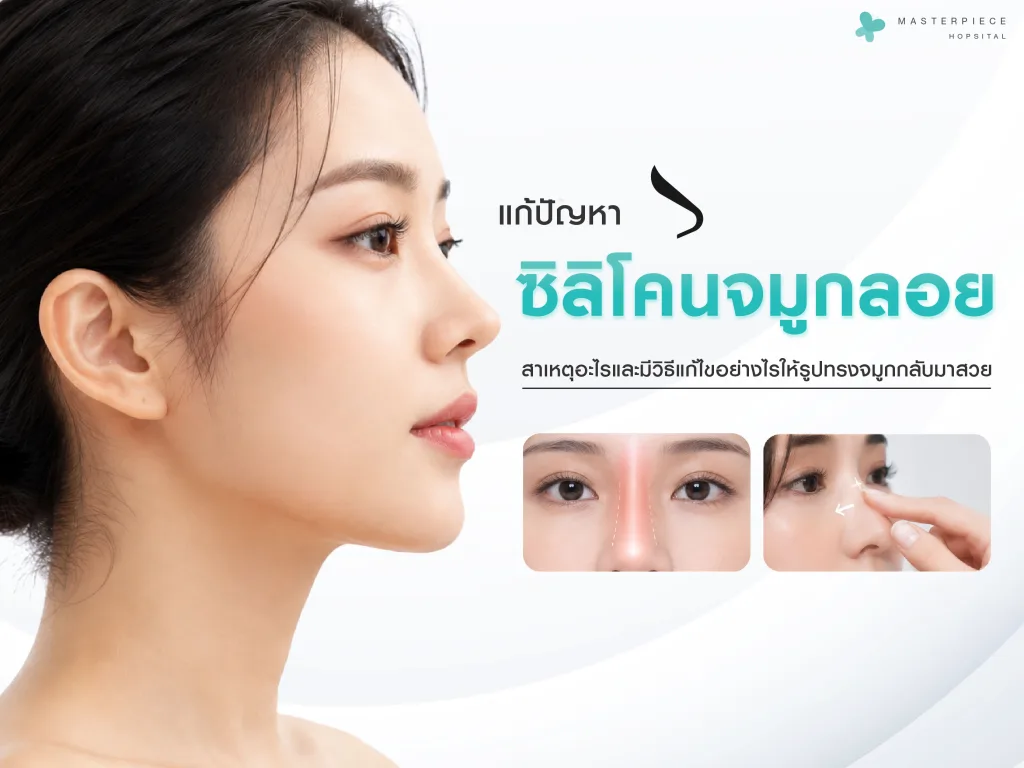 ปัญหาซิลิโคนจมูกลอยเกิดจากสาเหตุอะไรและมีวิธีแก้ไขอย่างไรให้รูปทรงจมูกกลับมาสวยมั่นคง