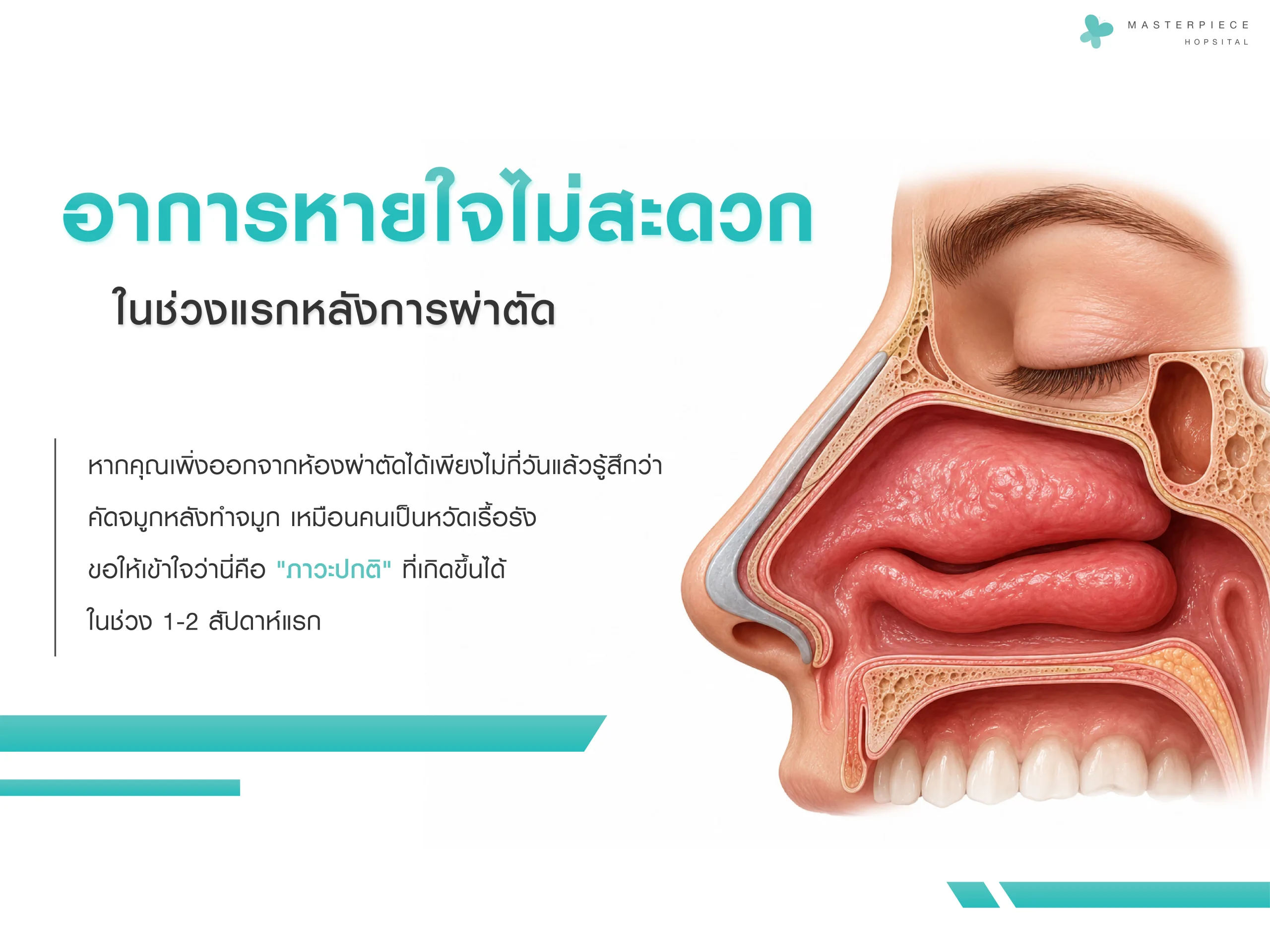 อาการหายใจไม่สะดวกในช่วงระยะแรกหลังการผ่าตัด