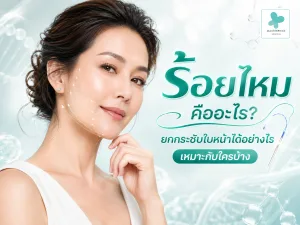 ร้อยไหม คืออะไร? ยกกระชับใบหน้าได้อย่างไร เหมาะกับใครบ้าง