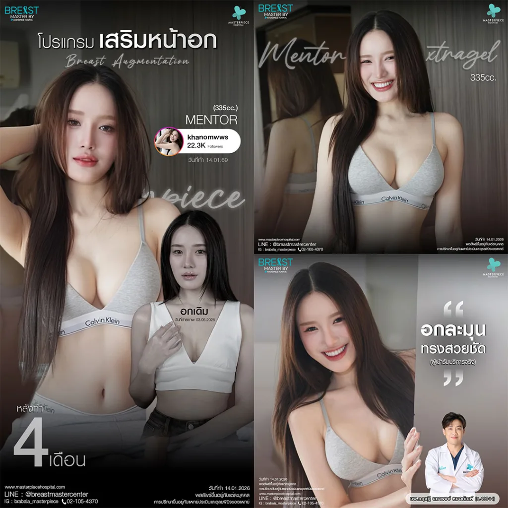 รีวิว เสริมหน้าอก 11