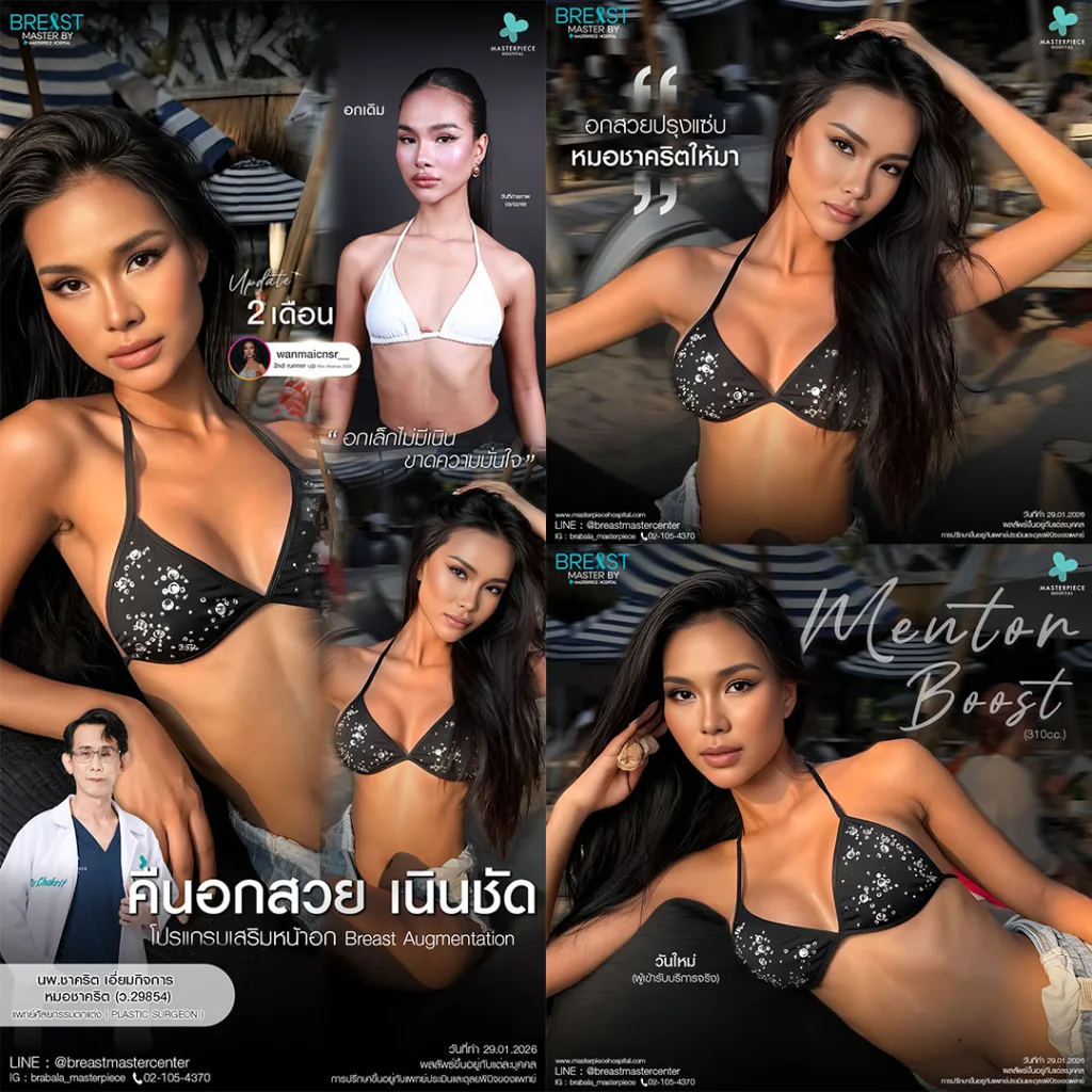 รีวิว เสริมหน้าอก 12