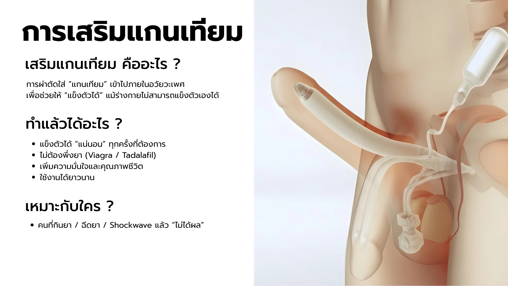 เสริมแกนองคชาตเทียม