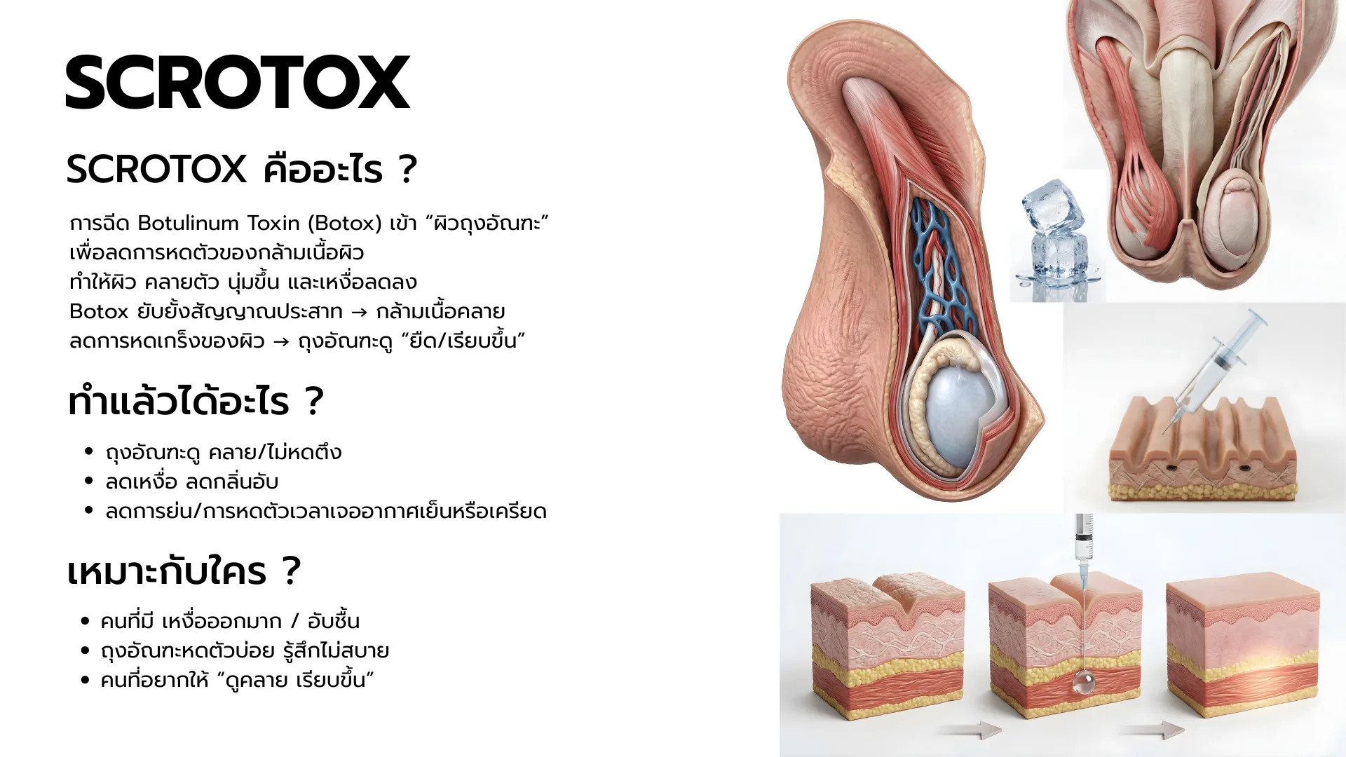 Scrotox For Men
