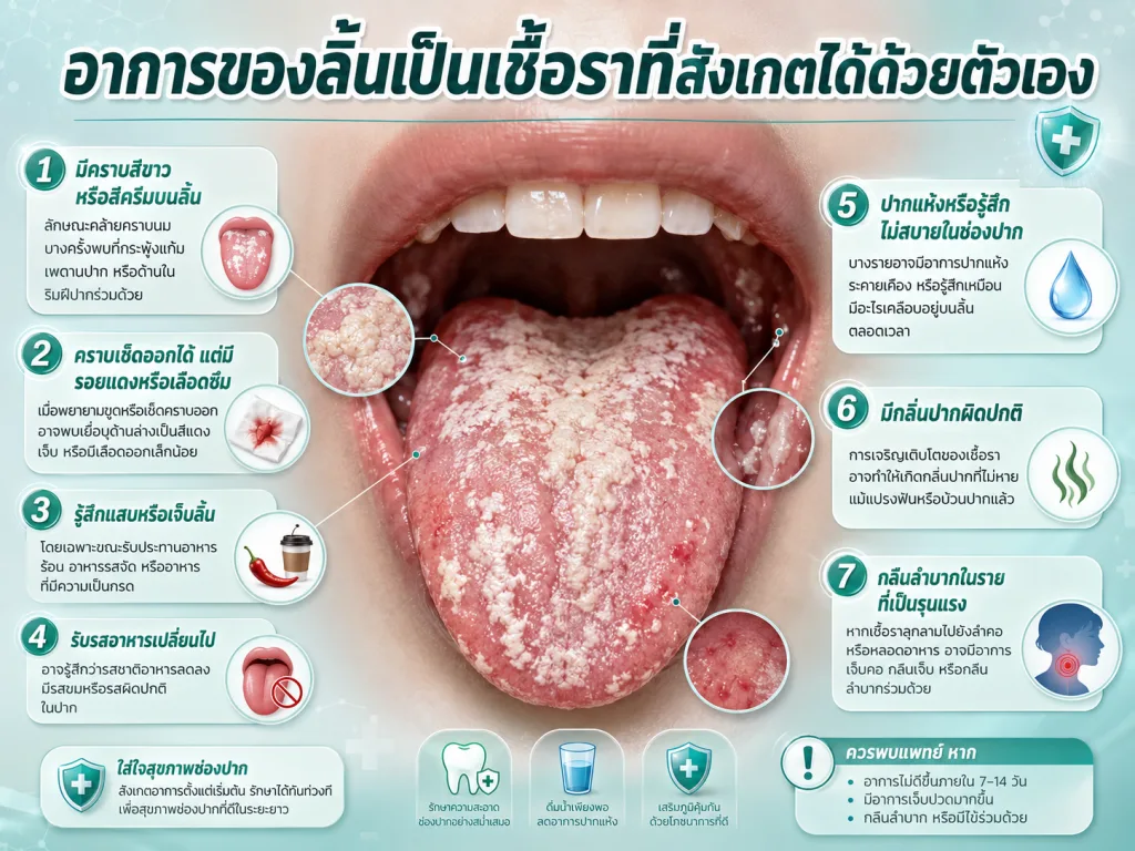 อาการของลิ้นเป็นเชื้อราที่สังเกตได้ด้วยตัวเอง