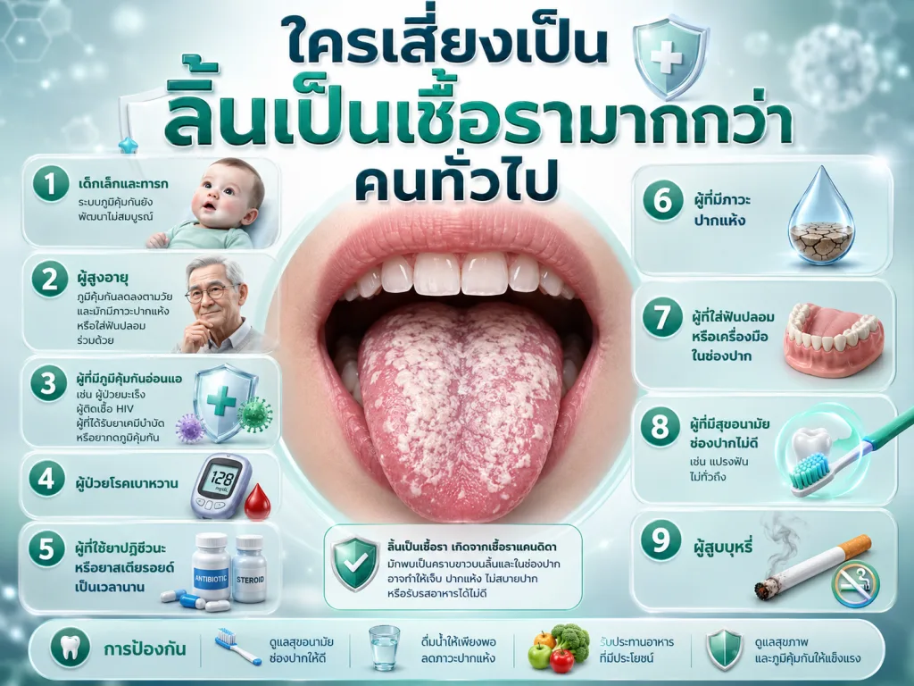 ใครเสี่ยงเป็นลิ้นเป็นเชื้อรามากกว่าคนทั่วไป