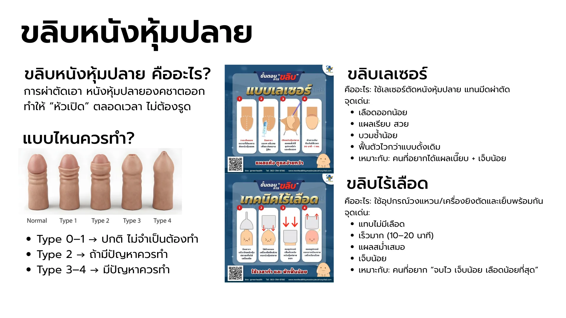 ขลิบไร้เลือด